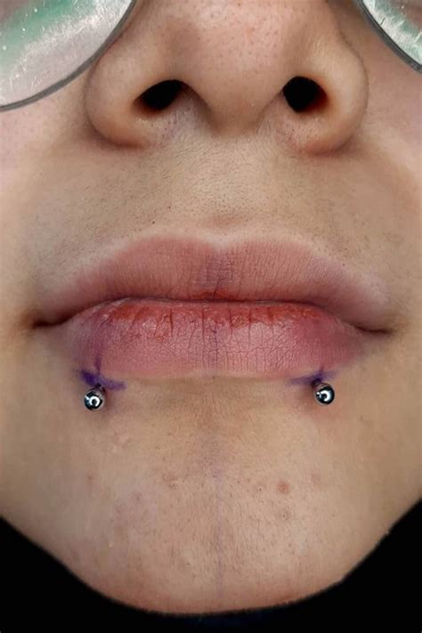 lip piercing snake bites|How to Pierce Snakebites: 7 Steps (with Pictures)